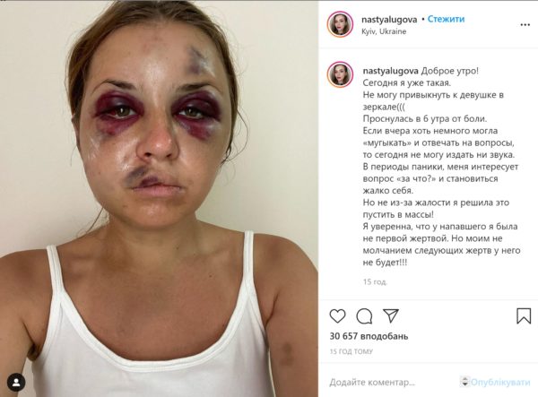 Про це не можна мовчати: жертва нападу в потязі Маріуполь-Київ розповіла про свій стан