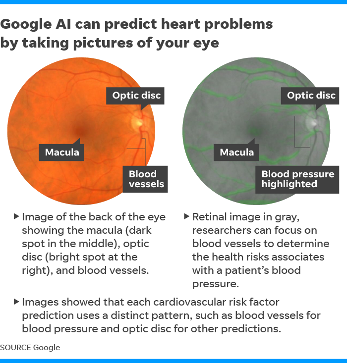 Google AI eye health Online